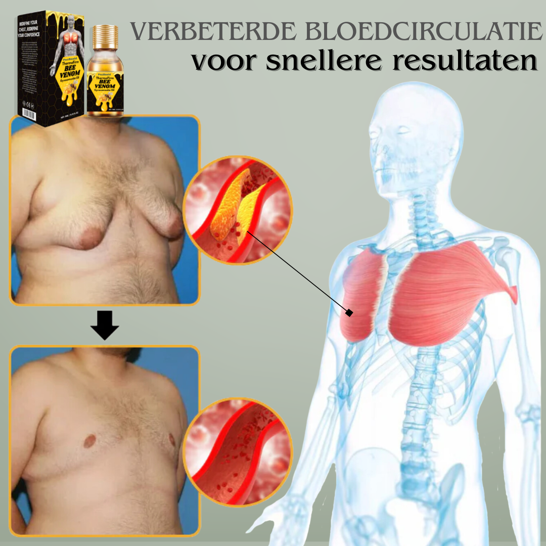 PecBeeld ThermoFirm